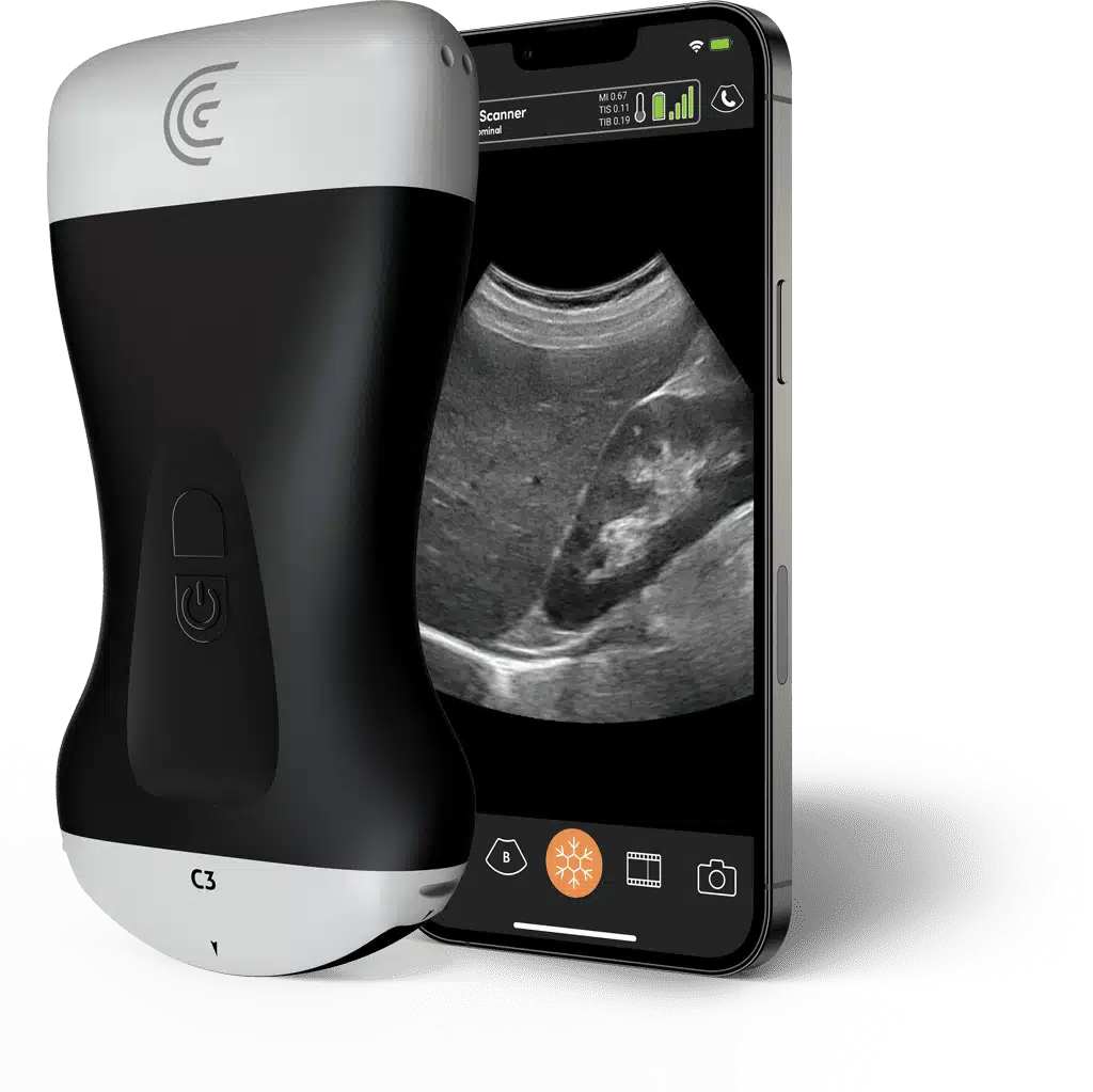 Product C3 Convex Handheld Portable Wireless Ultrasound Scanner.png