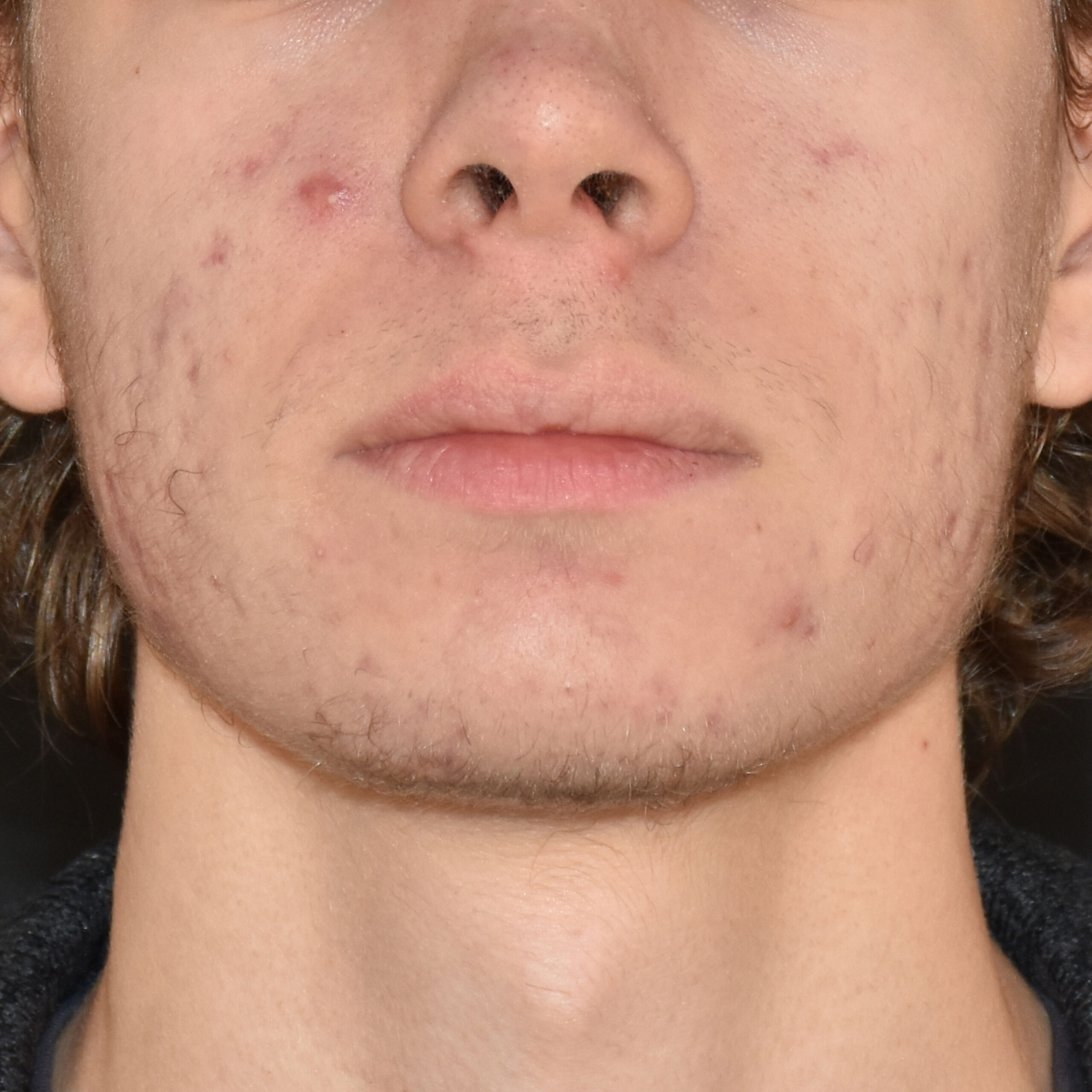 Case--8164 | After Medspa