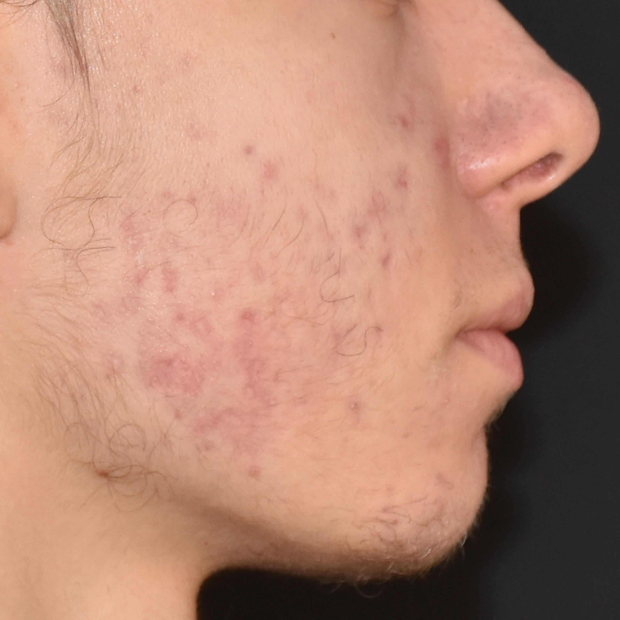 Case--8164 | After Face Treatments 3