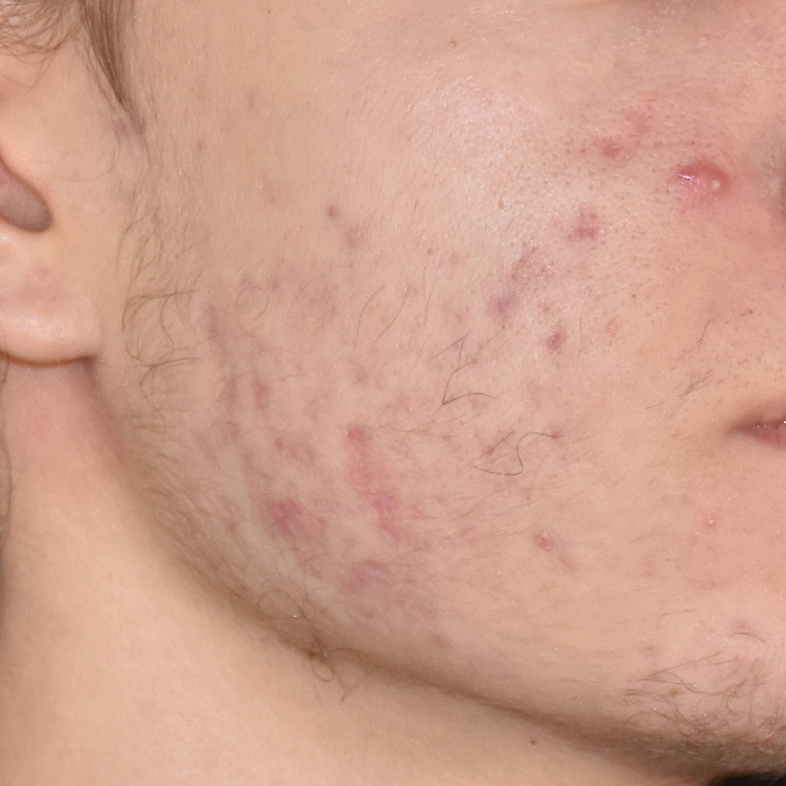 Case--8164 | After Face Treatments 2