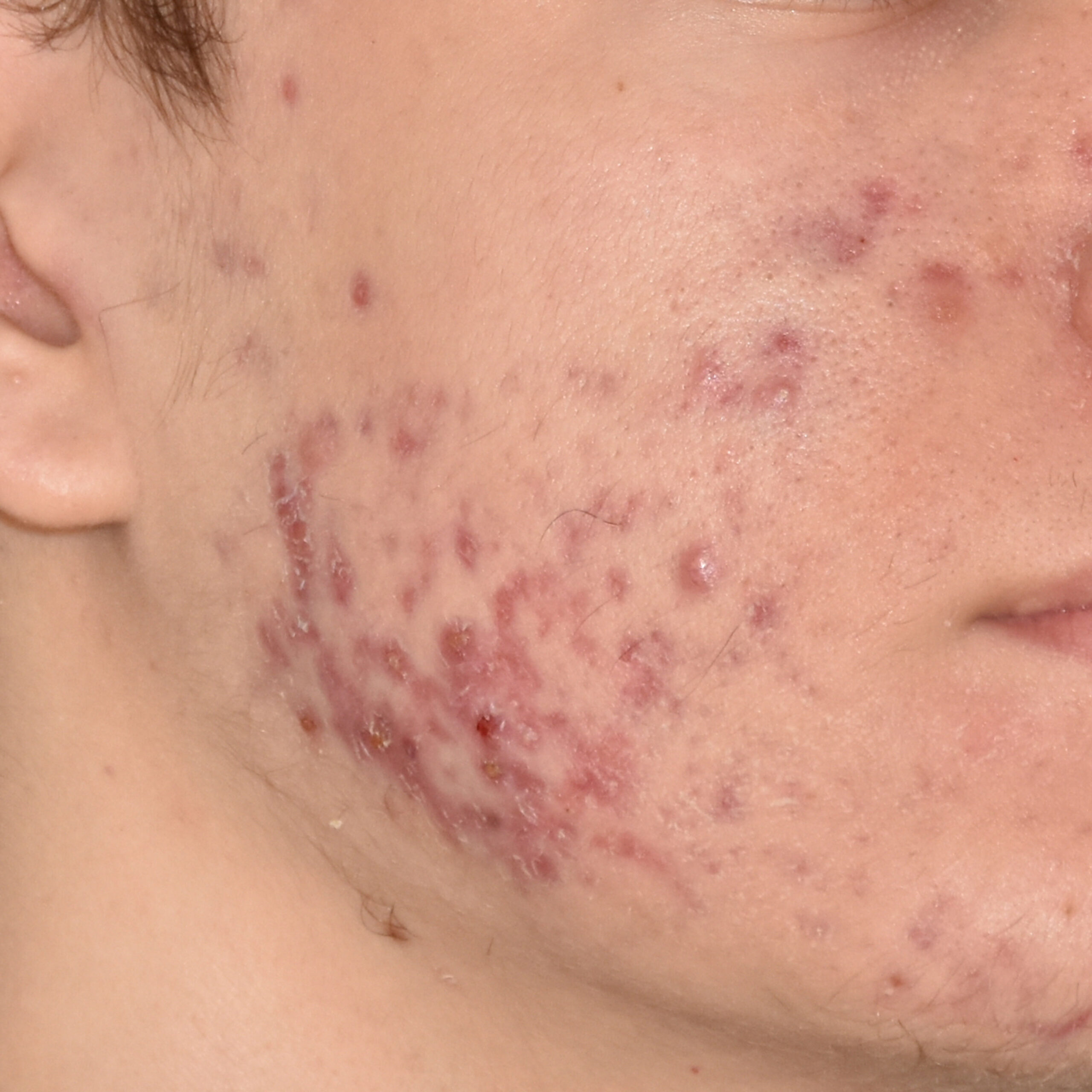 Case--8164 | Before Face Treatments 2