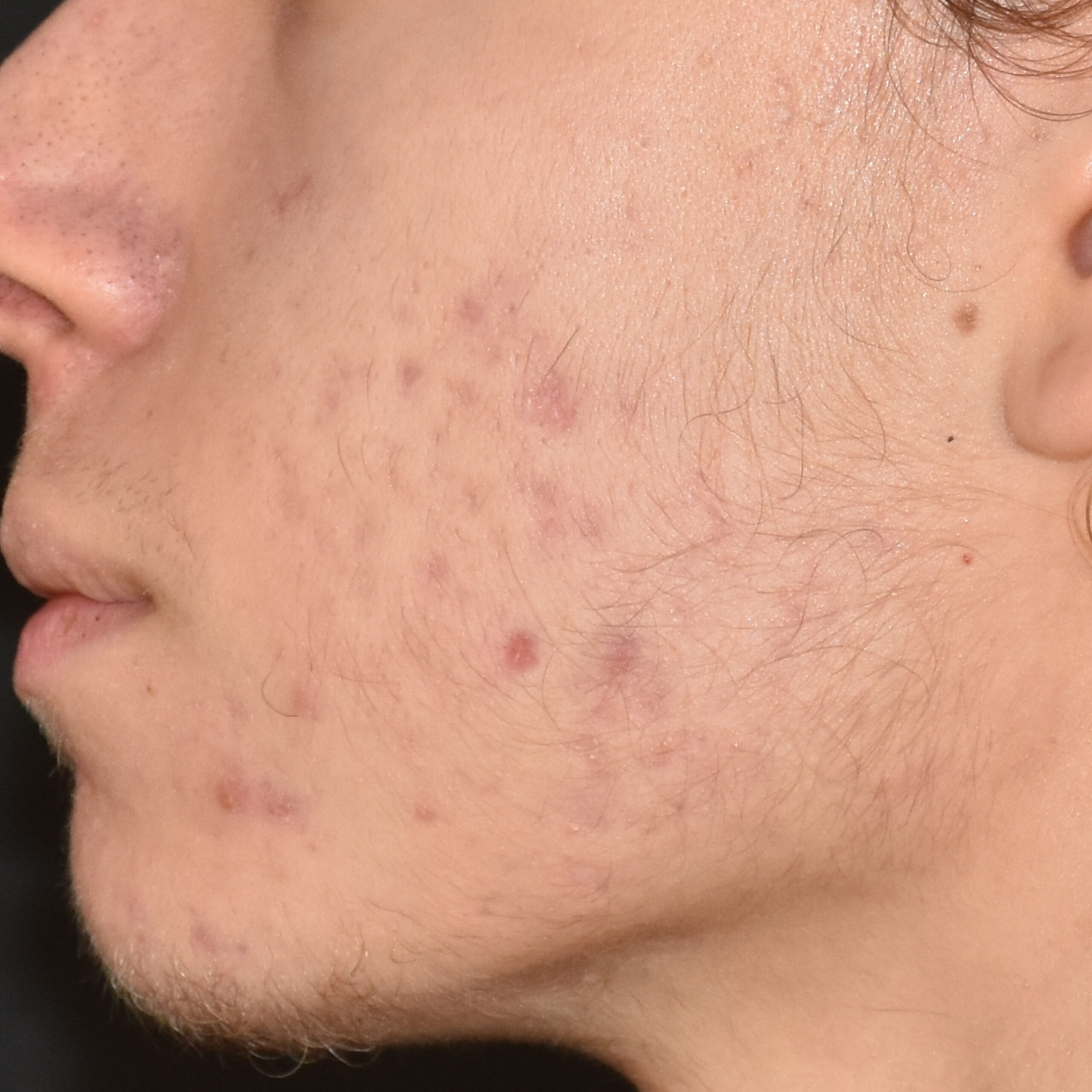 Case--8164 | After Face Treatments 5