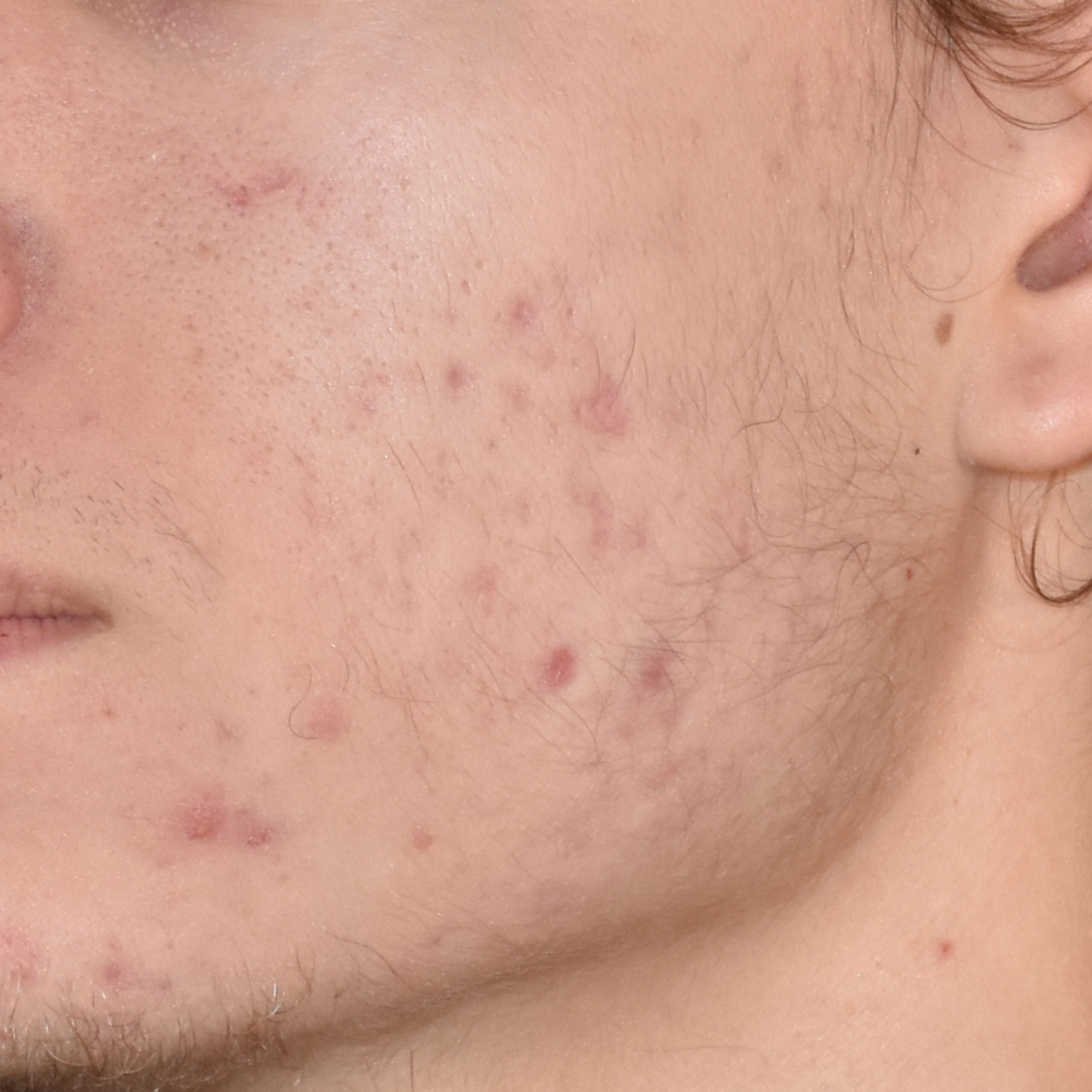 Case--8164 | After Face Treatments 4