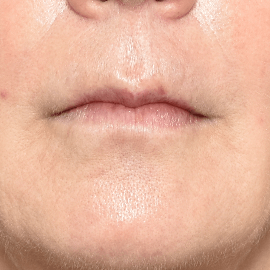 Before image of a patient