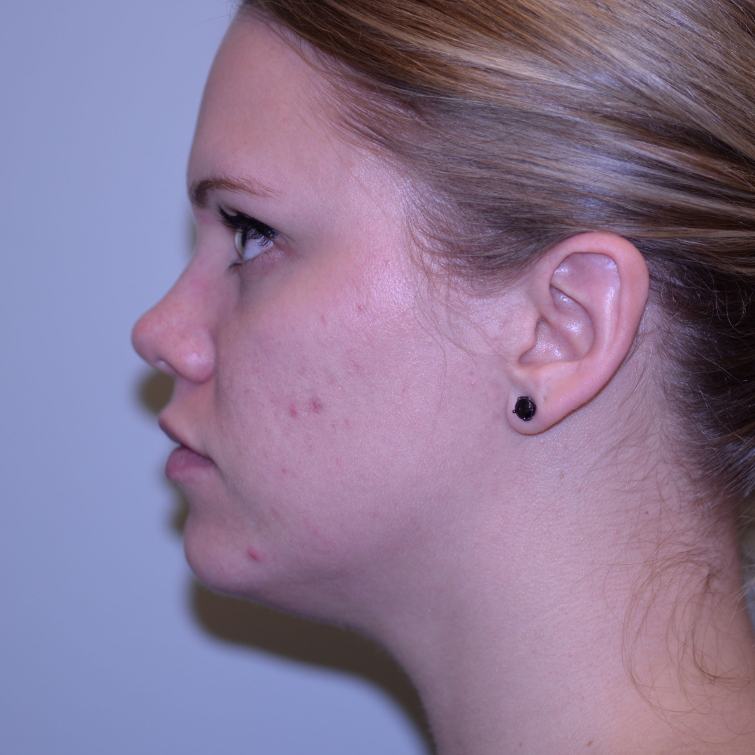 Case--3447 | Before Medspa