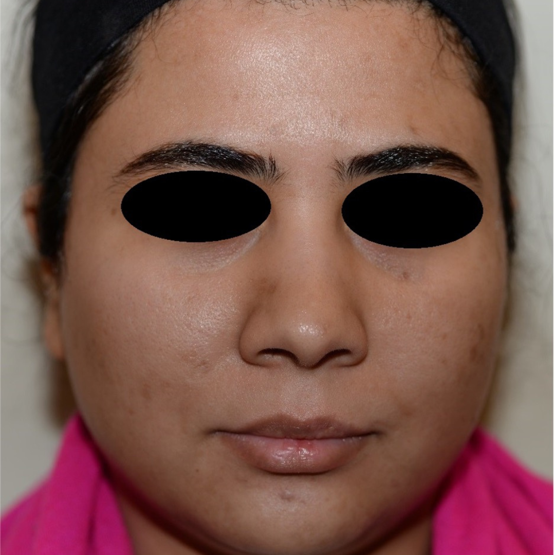 Case--2119 | Before Medspa