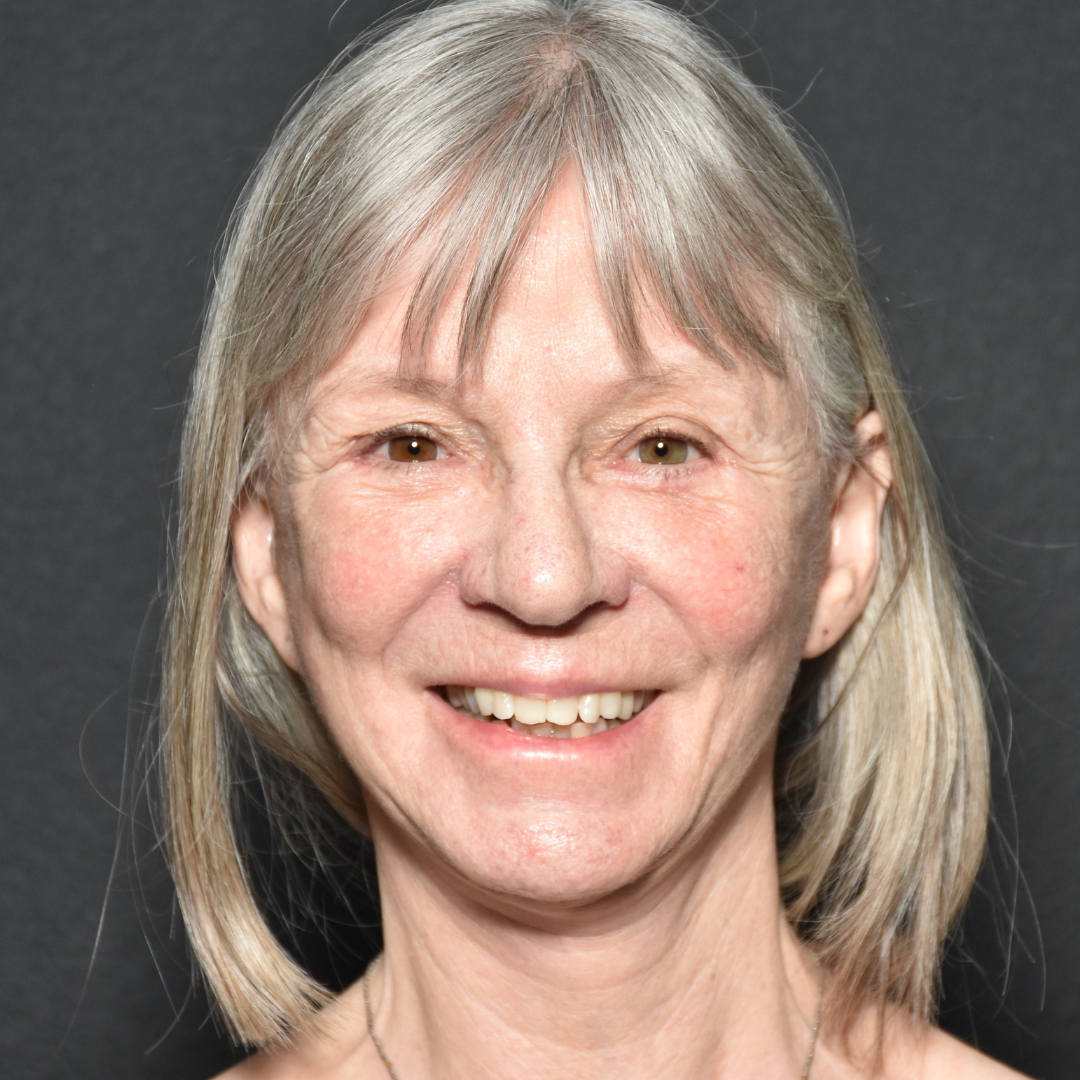 Case--5450 | After Facelift and Neck Lift