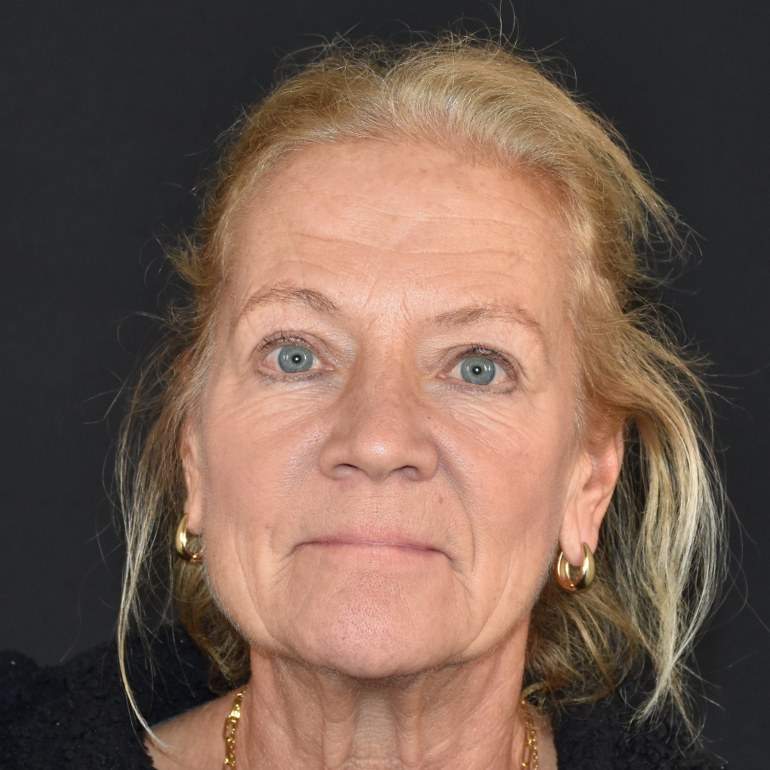 Case--4846 | After Medspa