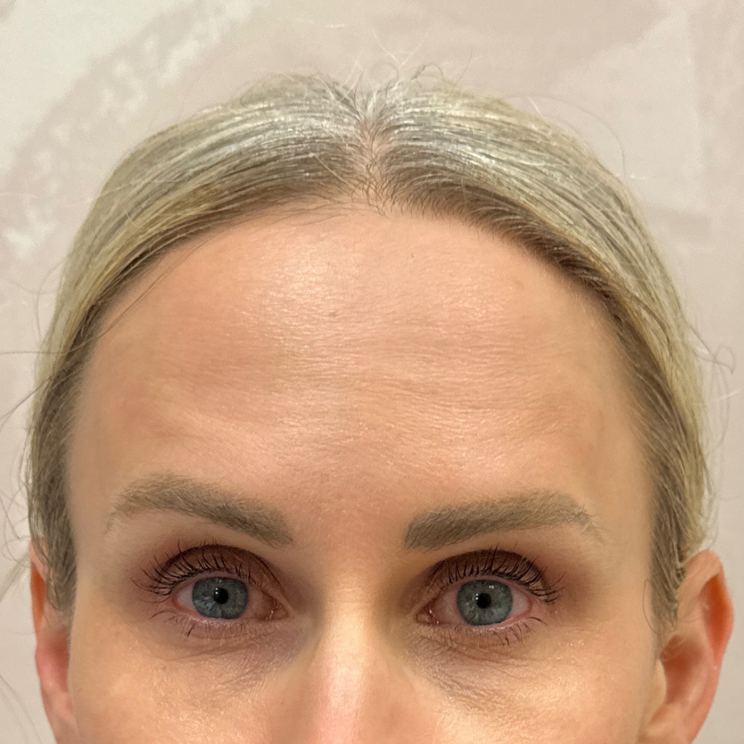 Case--4212 | After Medspa