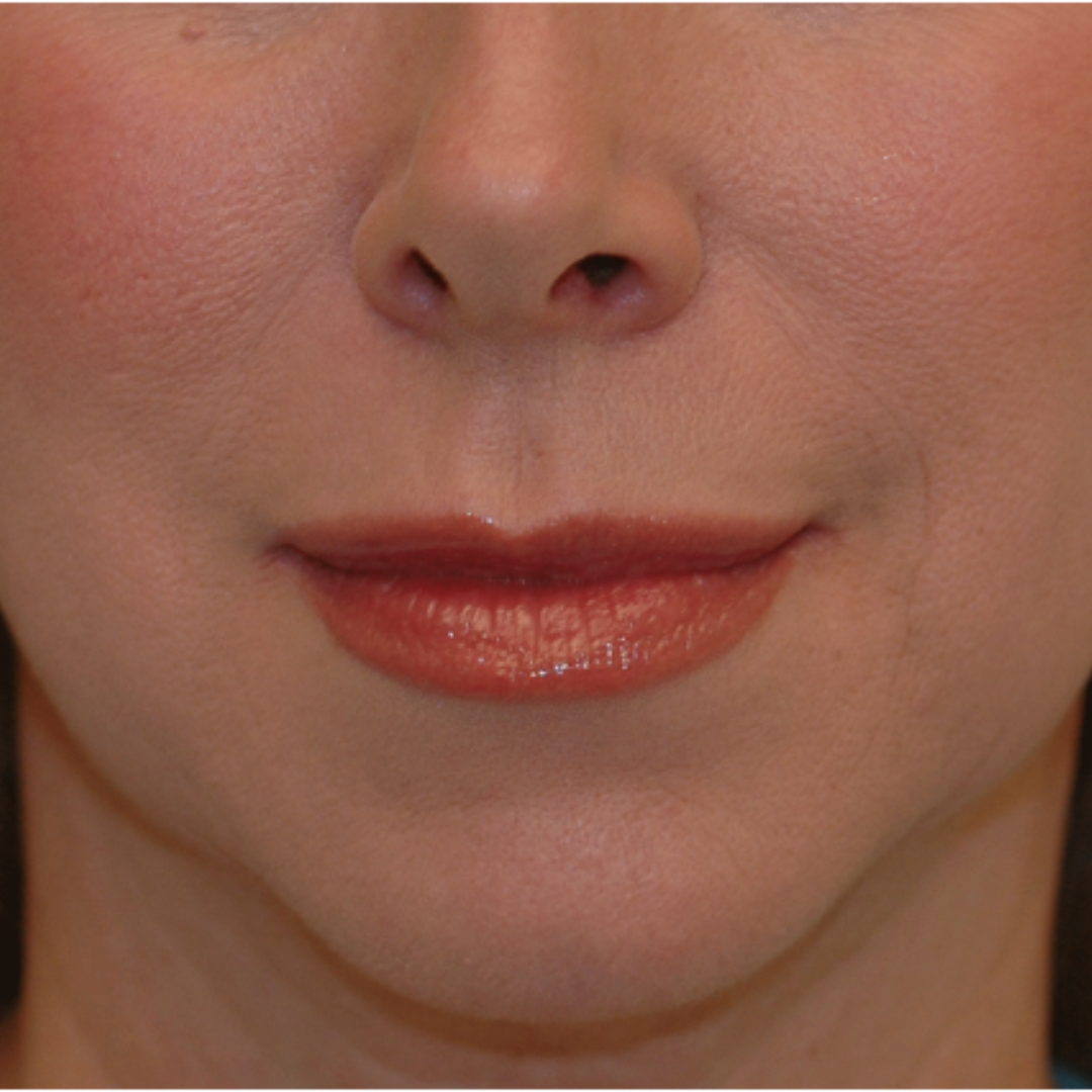 Case--6007 | After Medspa