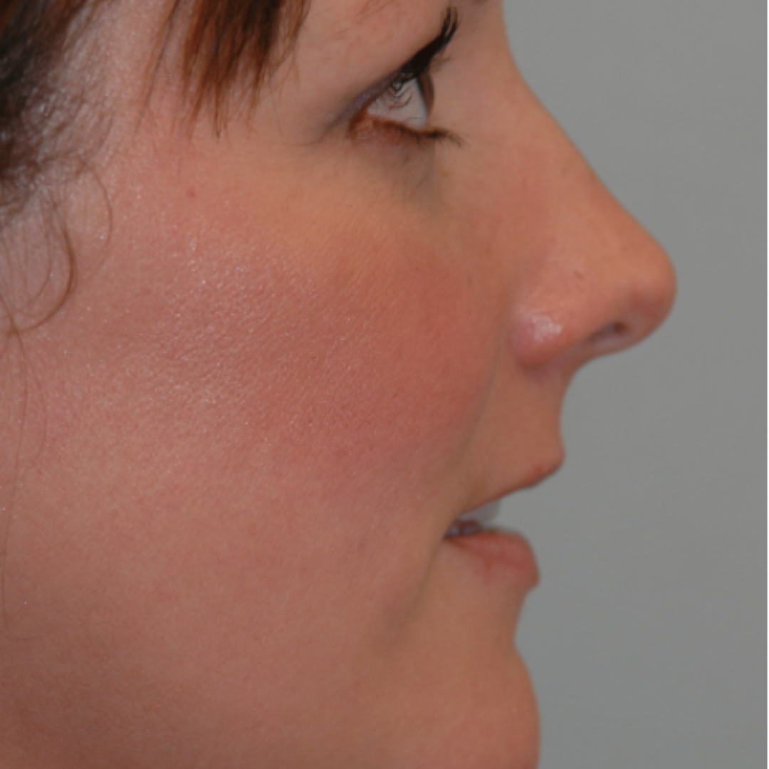 Case--9236 | After Medspa