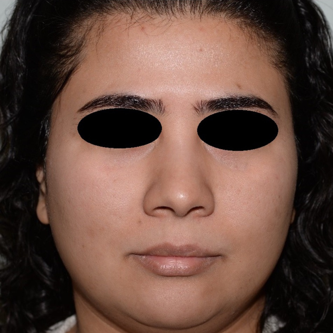 Case--2119 | After Medspa