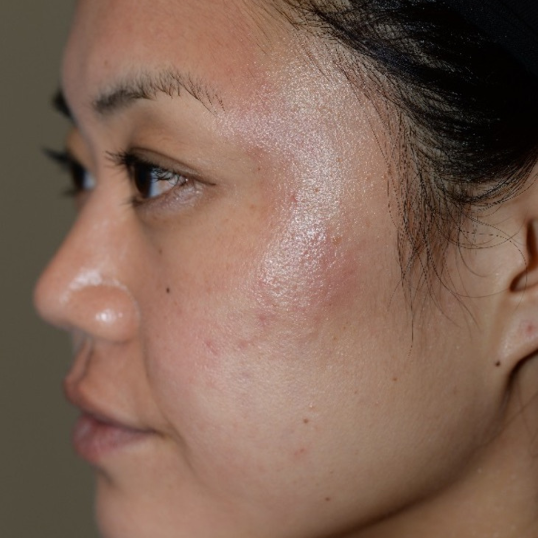 Case--6069 | Before Medspa