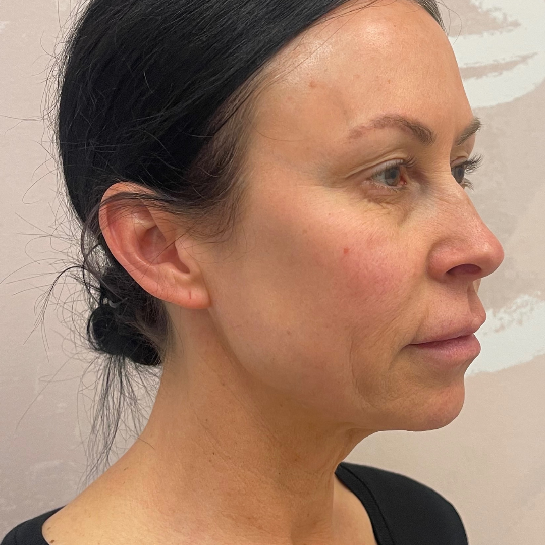 Case--7901 | Before PDO Threads 4