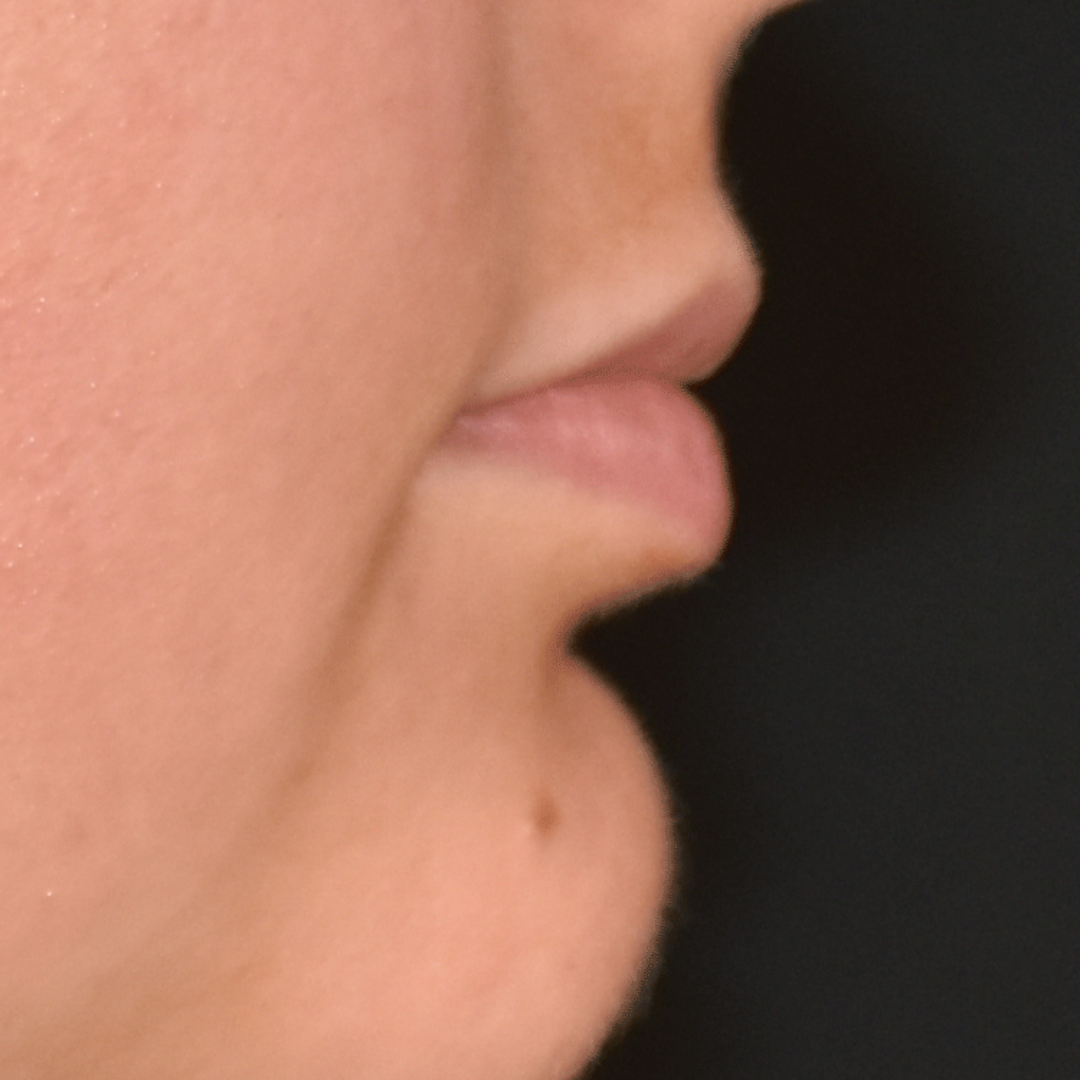 Case--8065 | Before Medspa