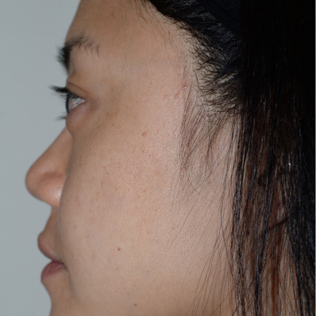 Case--6069 | After Medspa