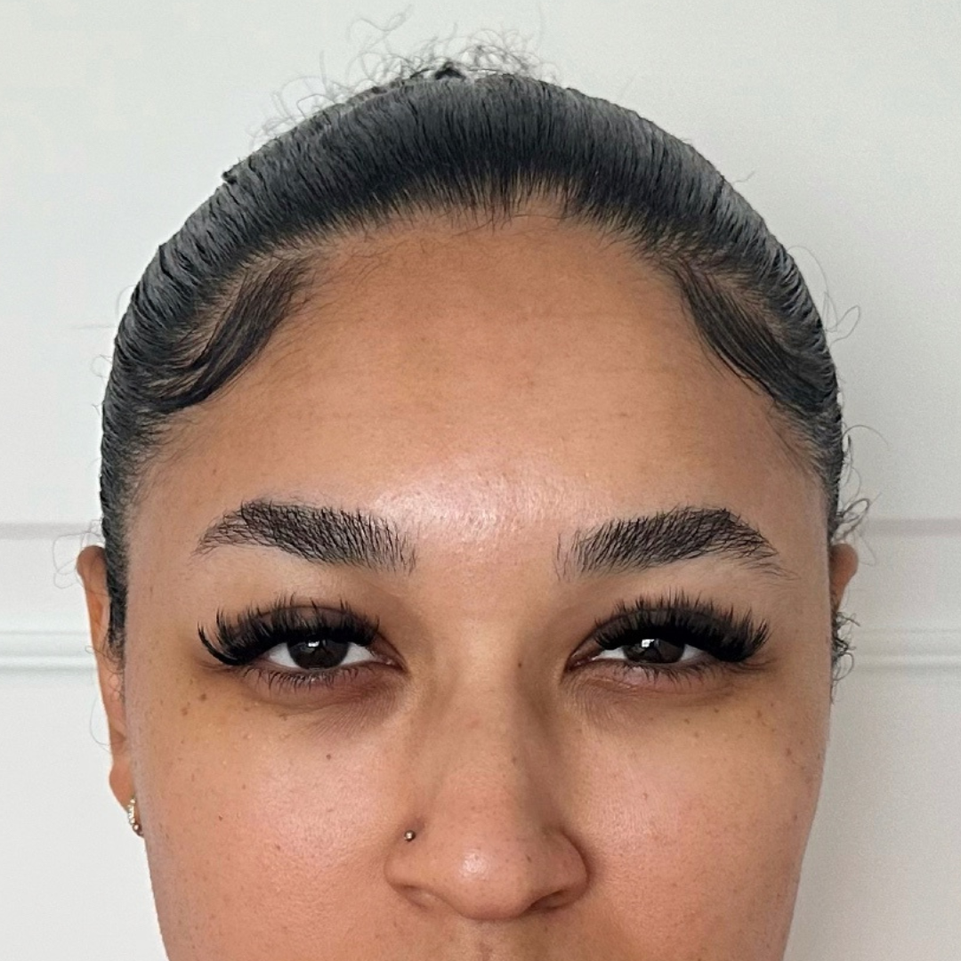 Case--5478 | After Medspa