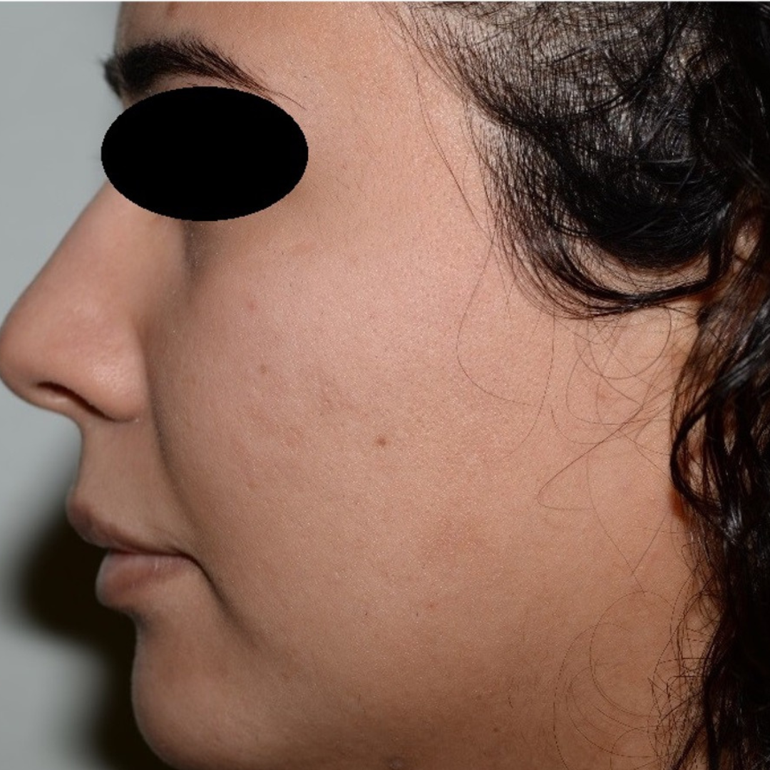 Case--2119 | After Medical Grade Skincare 3