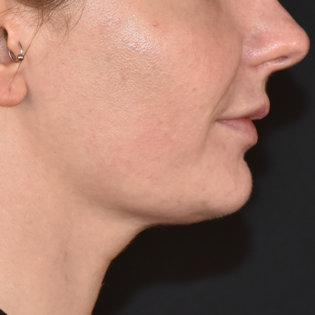 Case--2605 | After Medspa