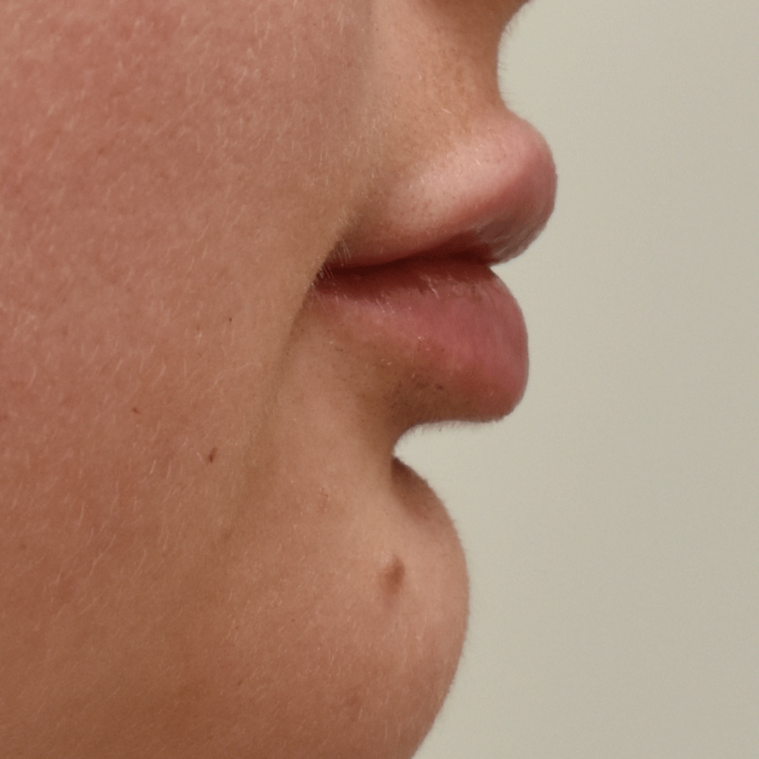 Case--8065 | After Medspa