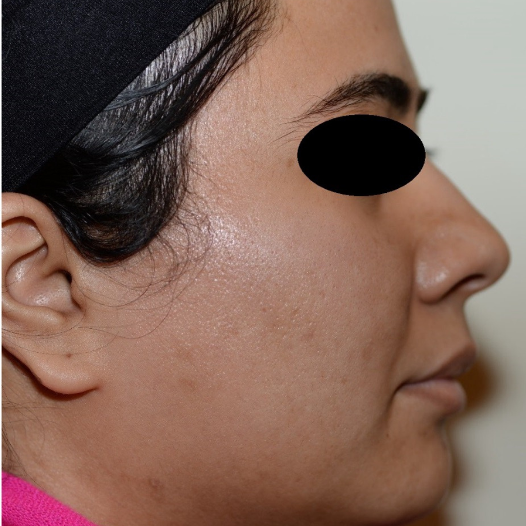 Case--2119 | Before Medical Grade Skincare 2