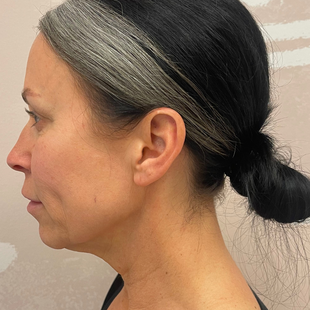 Case--7901 | Before PDO Threads 3