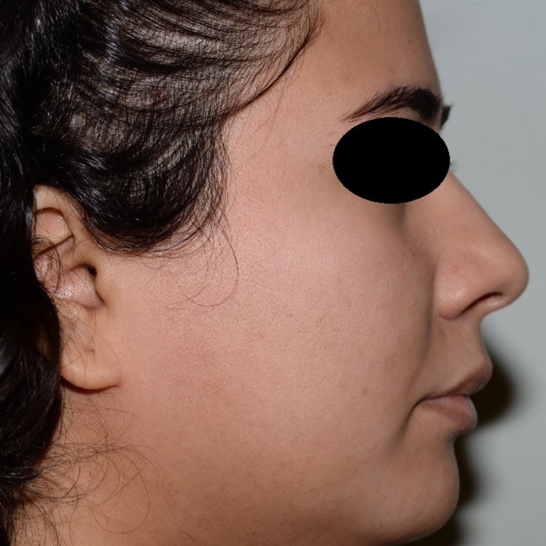 Case--2119 | After Medical Grade Skincare 2