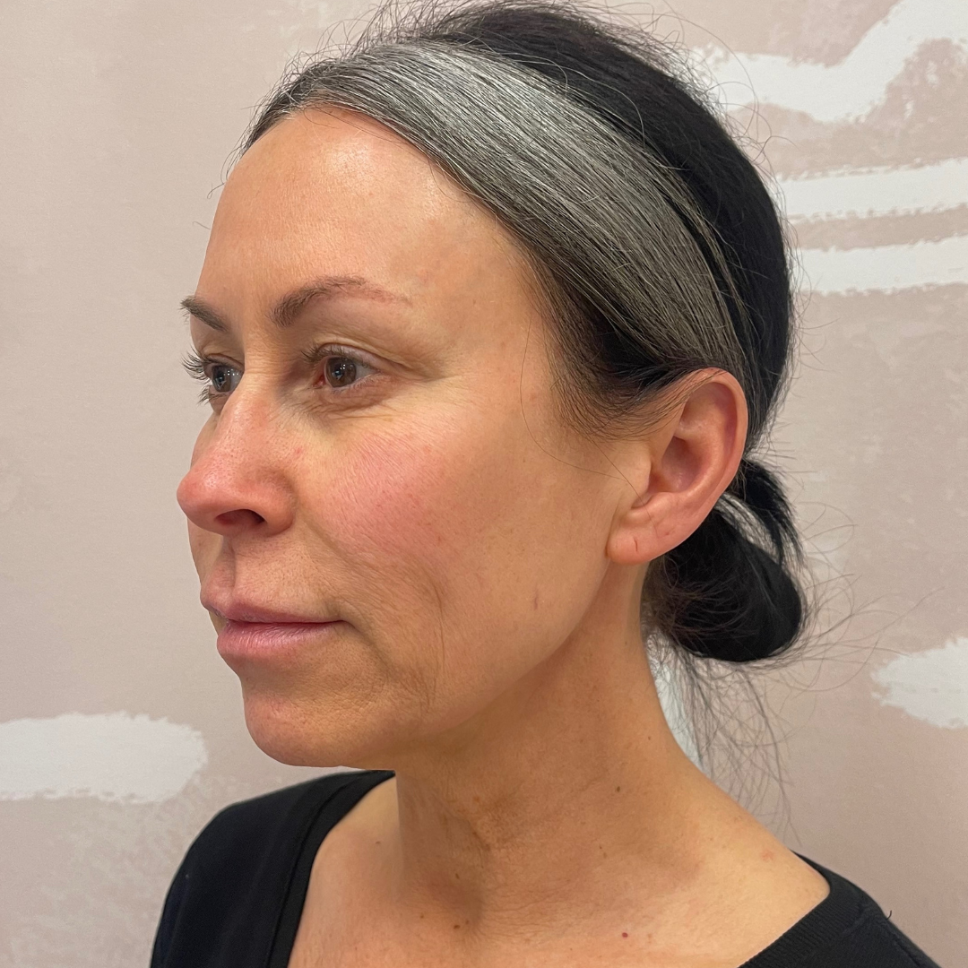 Case--7901 | Before PDO Threads 2