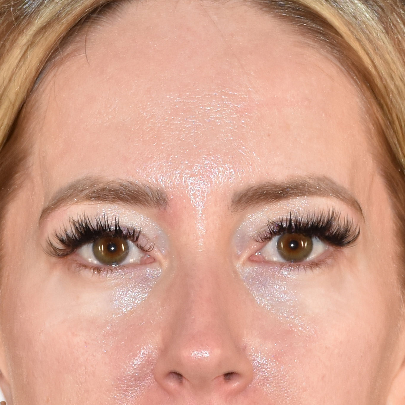 Case--5182 | After Medspa