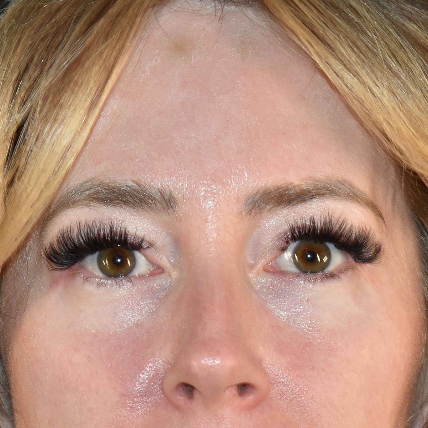 Case--5182 | Before Medspa