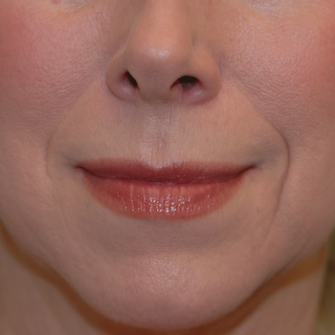 Case--6007 | Before Medspa