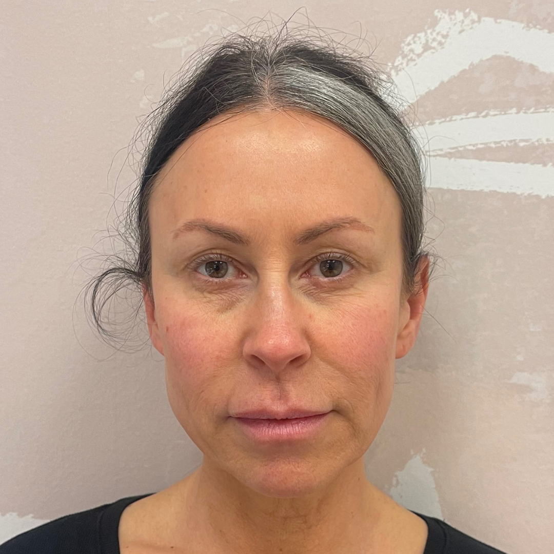 Case--7901 | Before Medspa