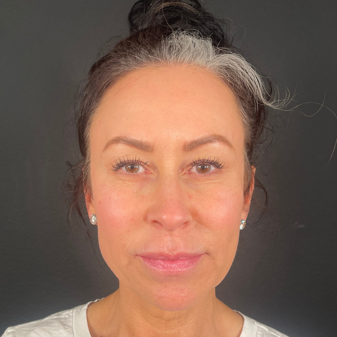 Case--7901 | After Medspa