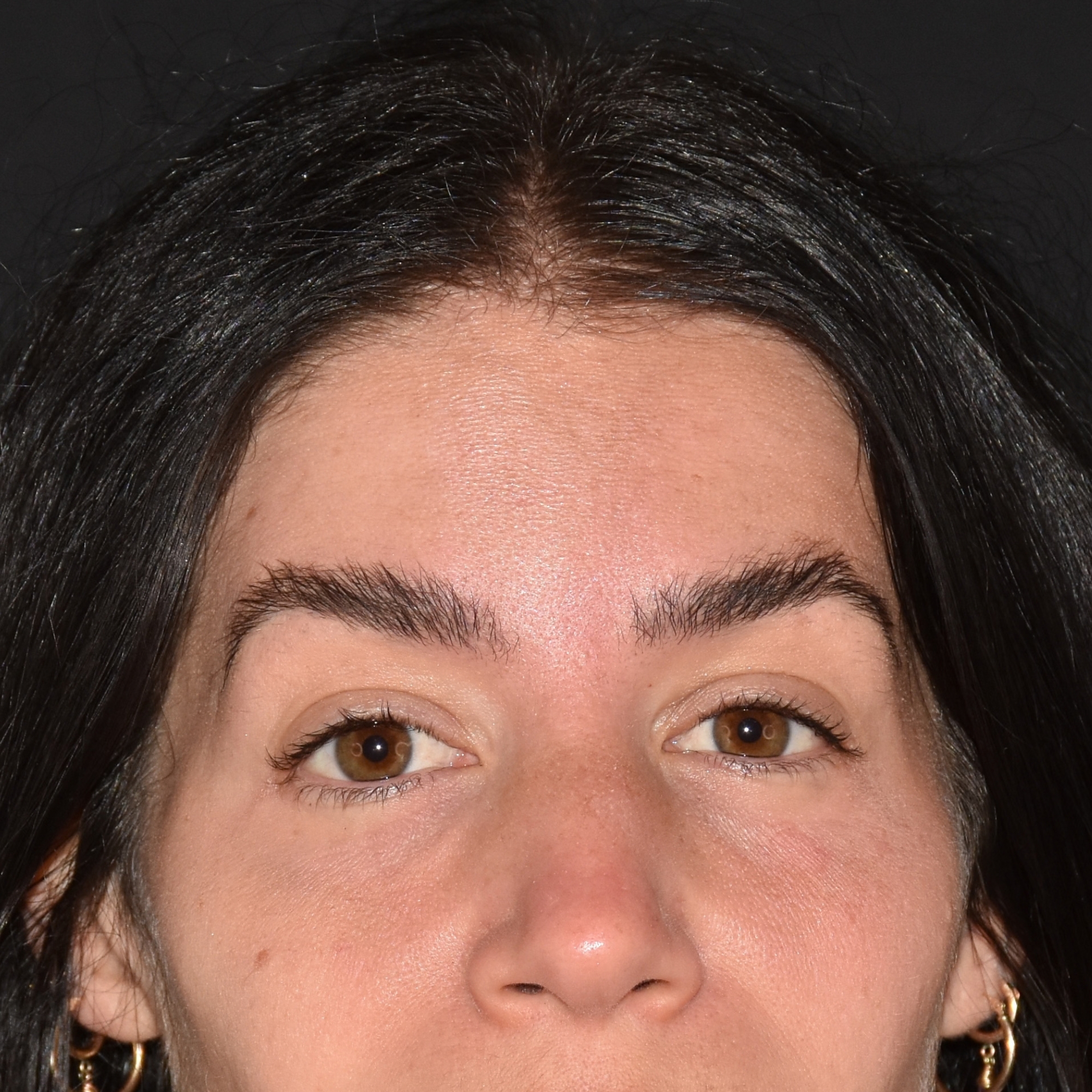 Case--4749 | After Face Treatments