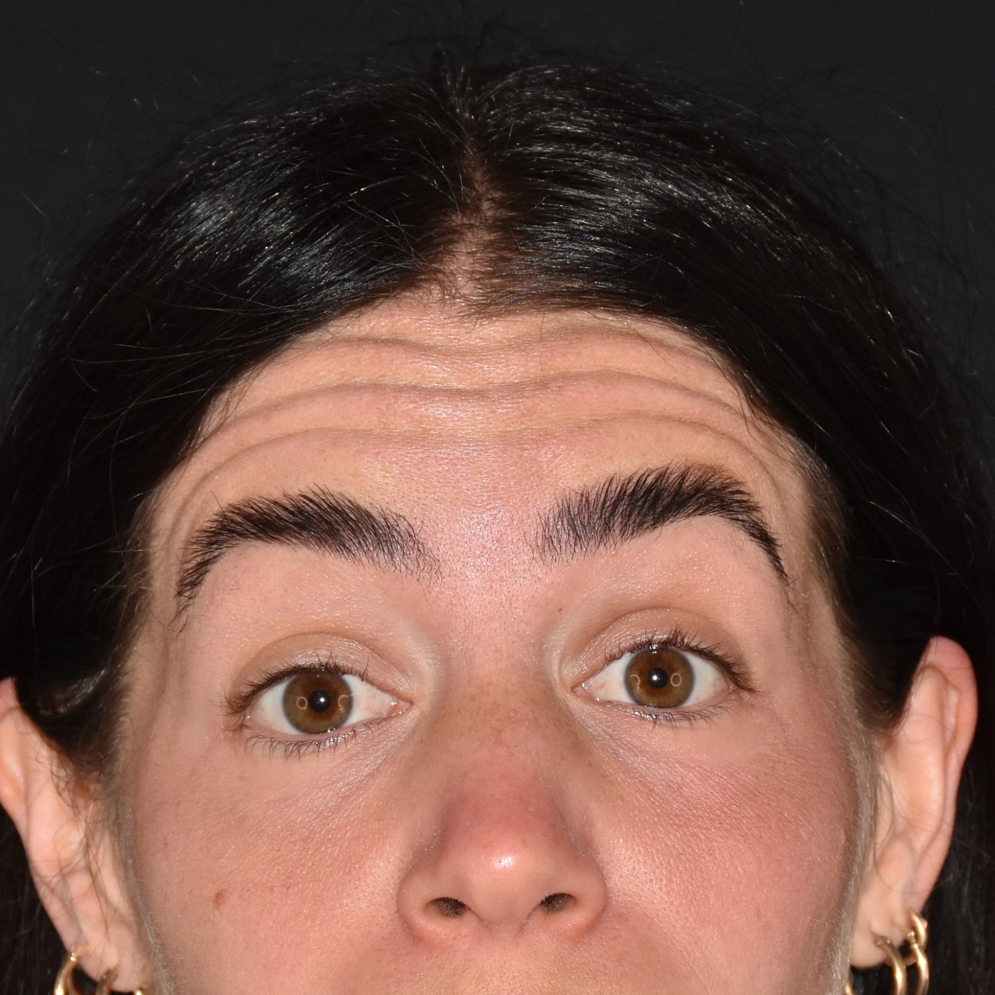 Case--4749 | Before Face Treatments