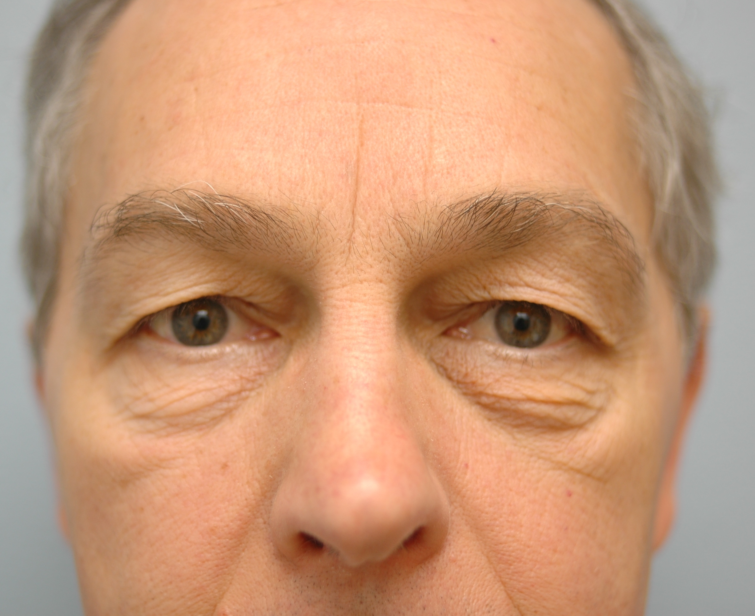 Case--4034 | Before Face