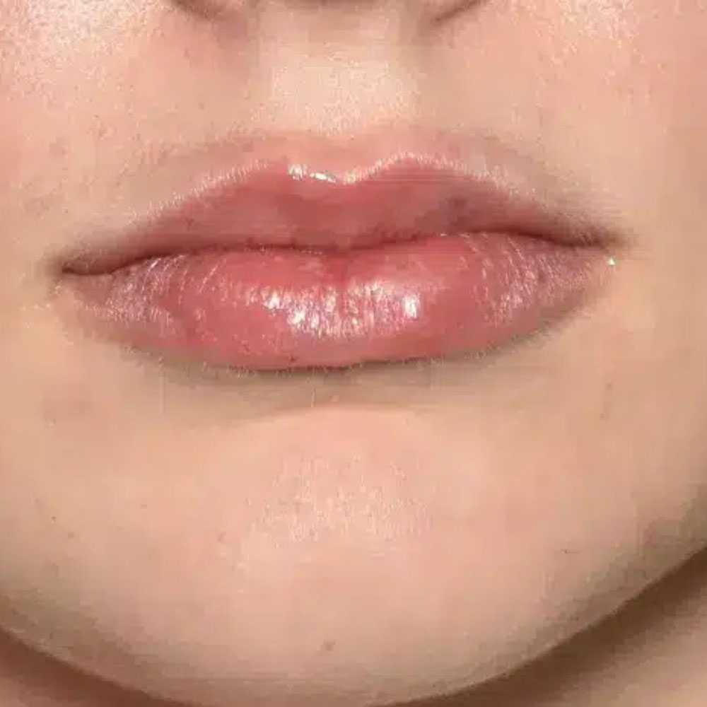 Case--2142 | After Medspa