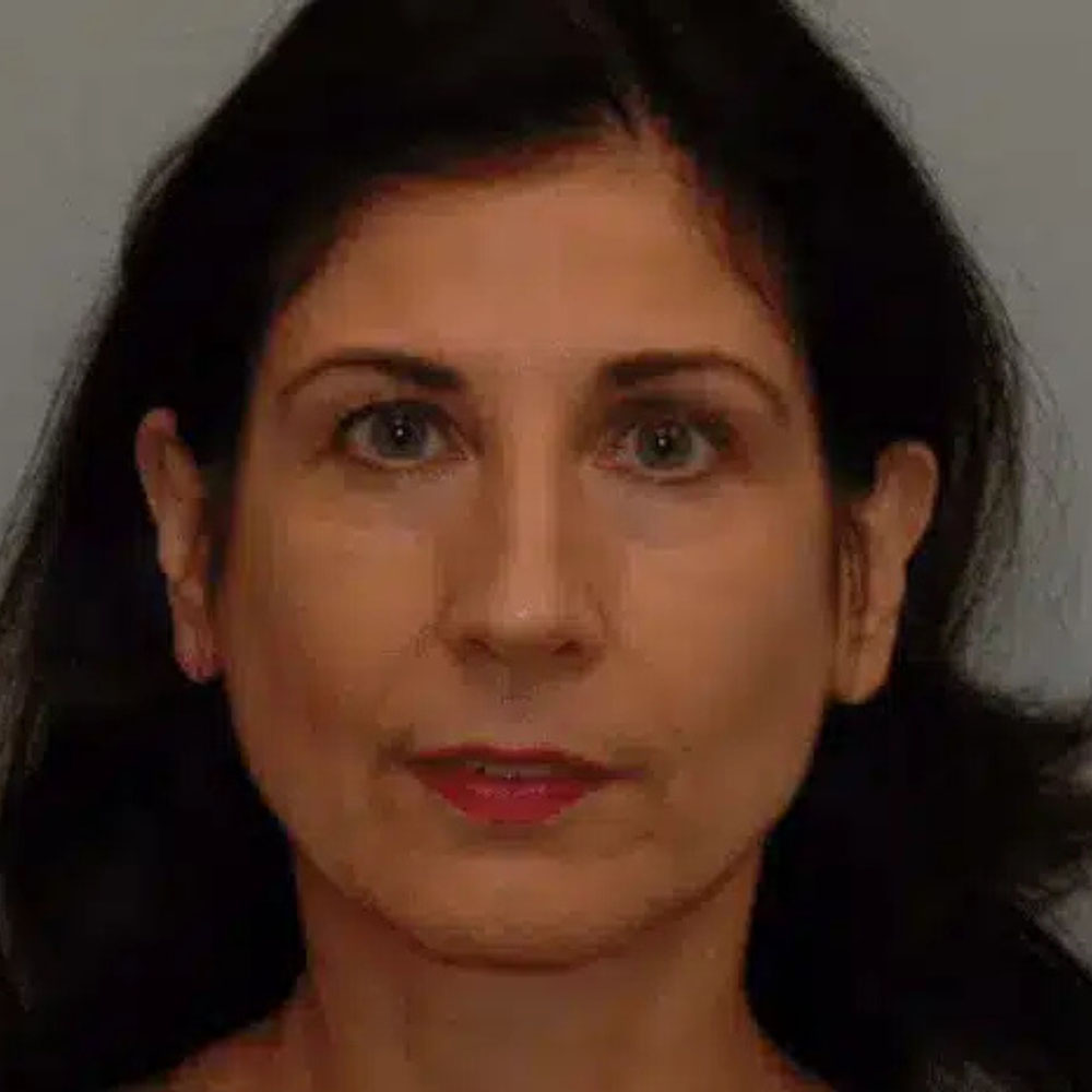 Case--2143 | Before Medspa