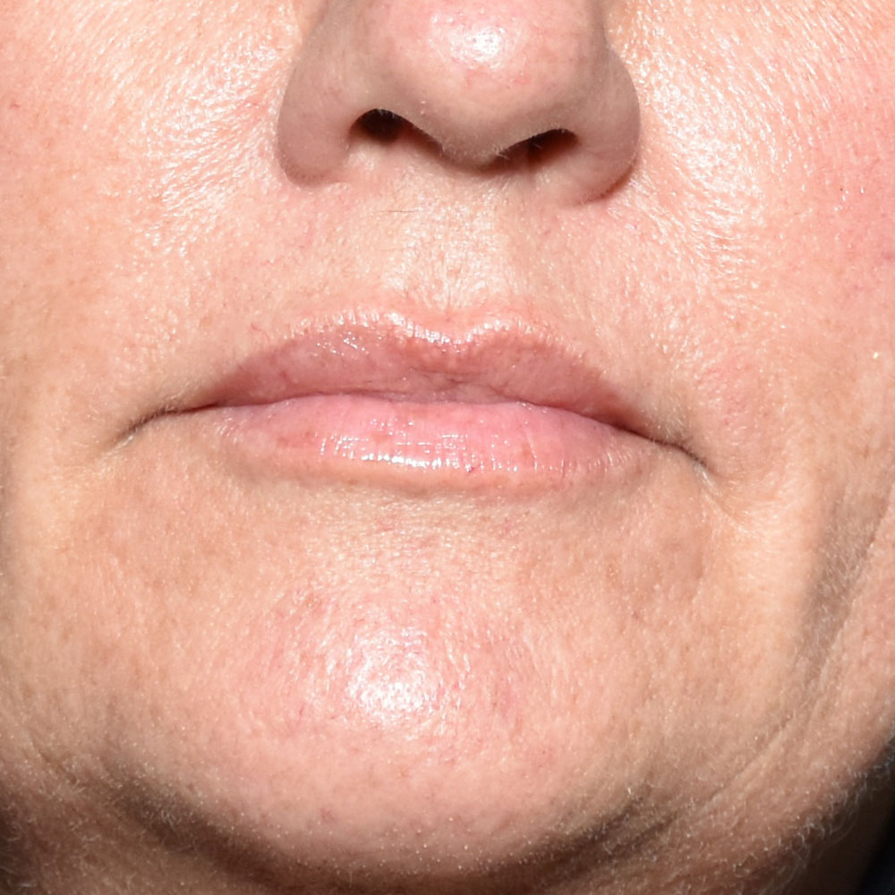 Case--2145 | After Medspa