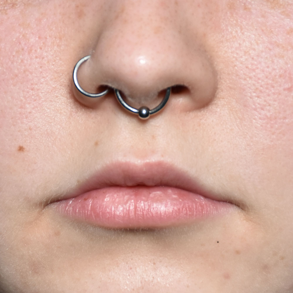 Case--2147 | Before Medspa