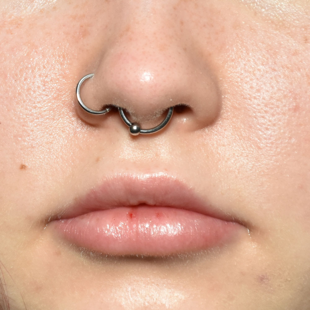 Case--2147 | After Medspa