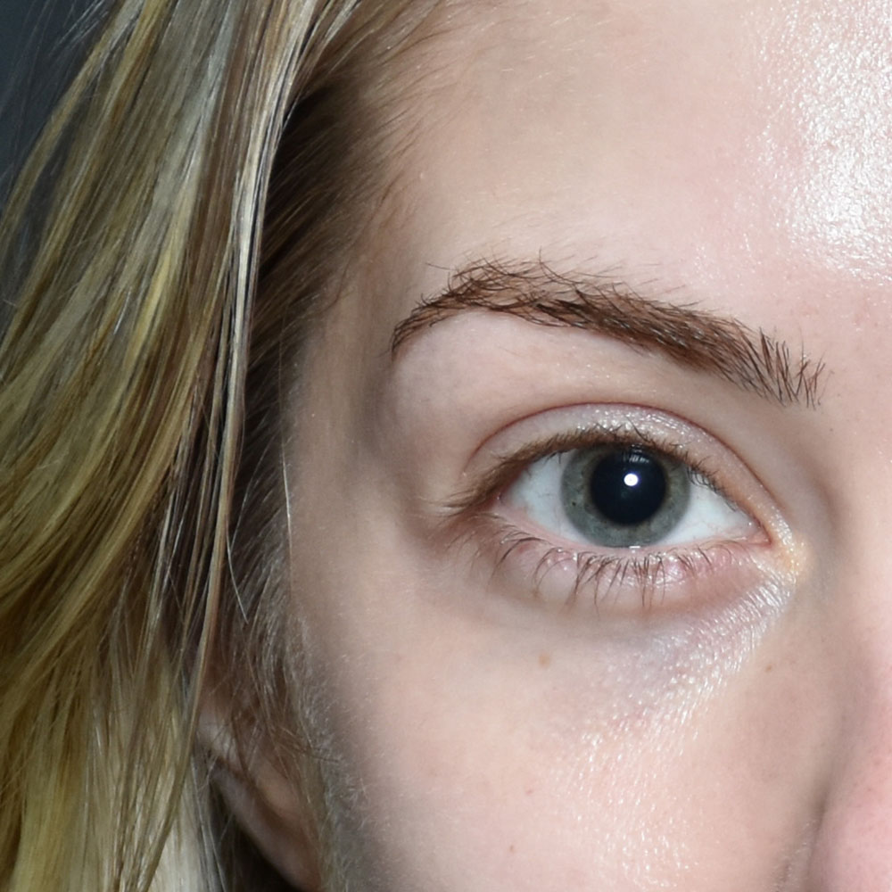 Case--2148 | Before Medspa