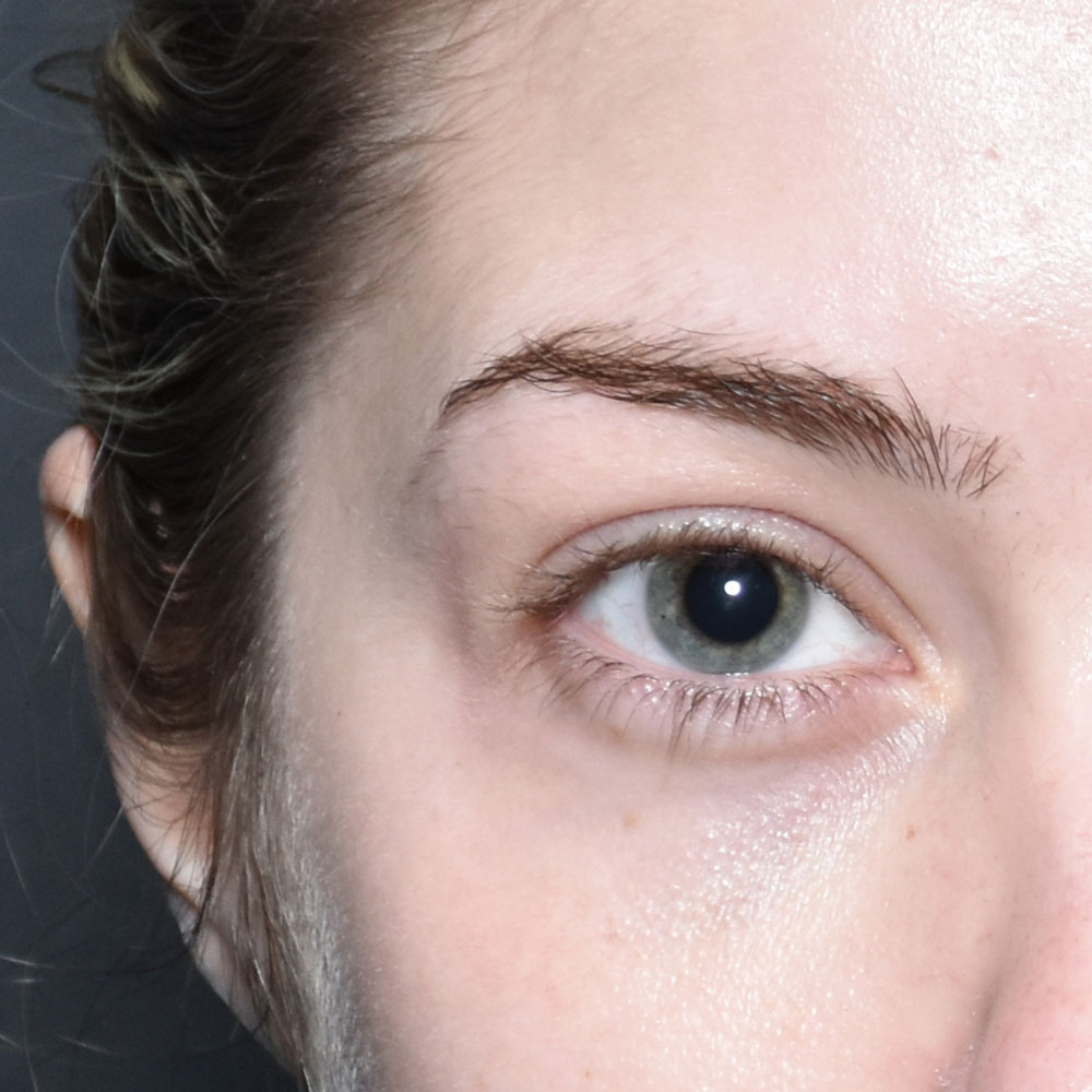 Case--2148 | After Medspa