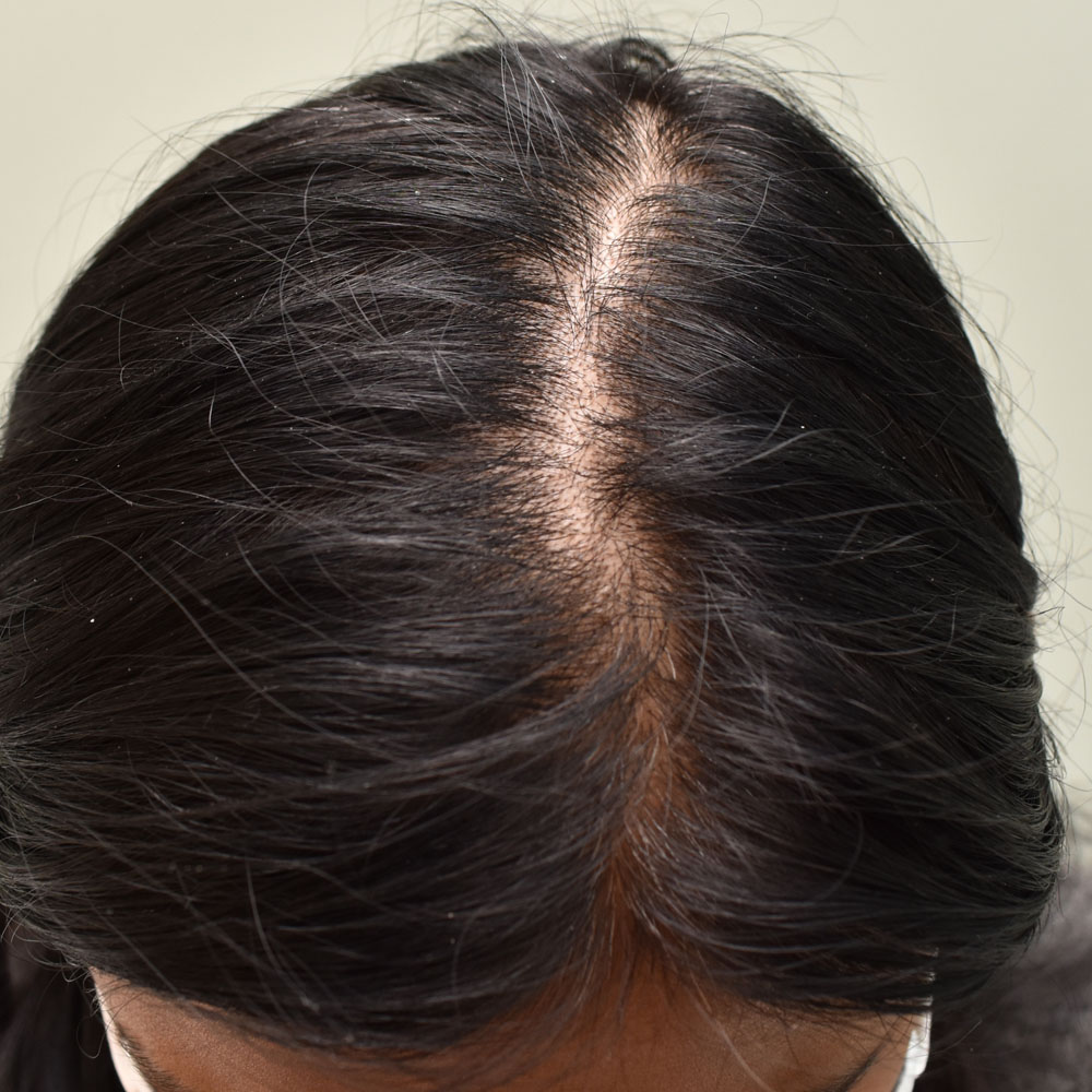 9076 Before Hair Treatment