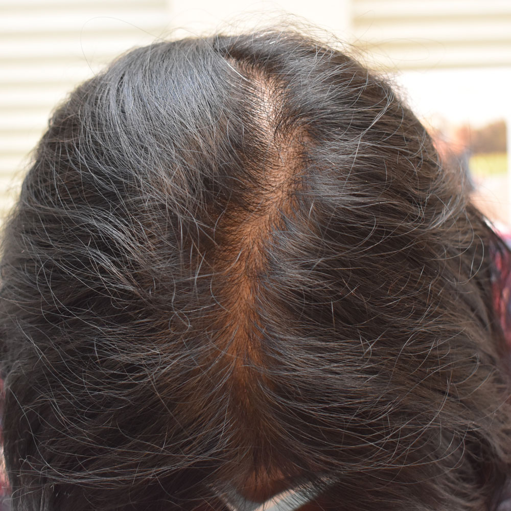 9076 After Hair Treatment