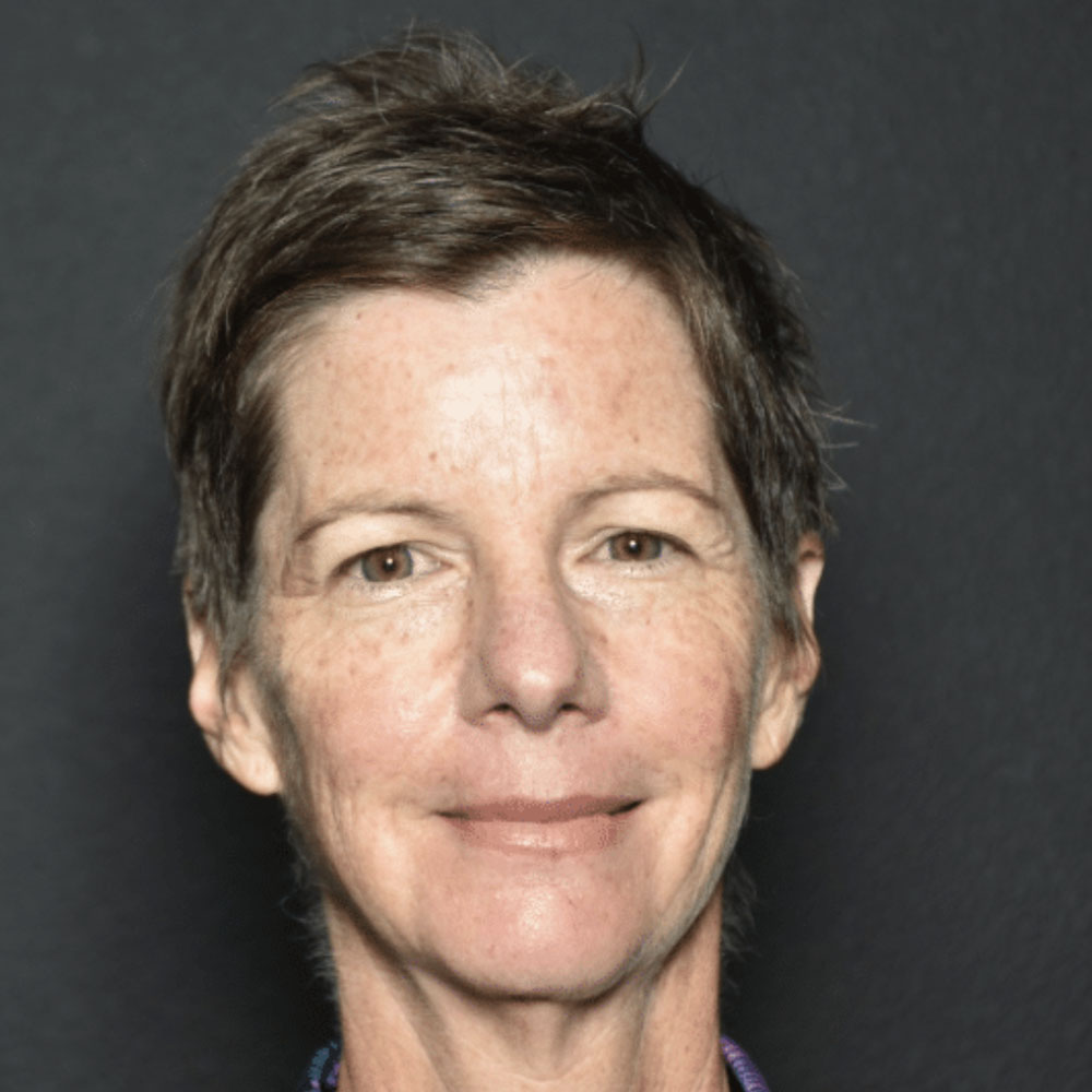 Case--2130 | Before IPL & Laser Treatments