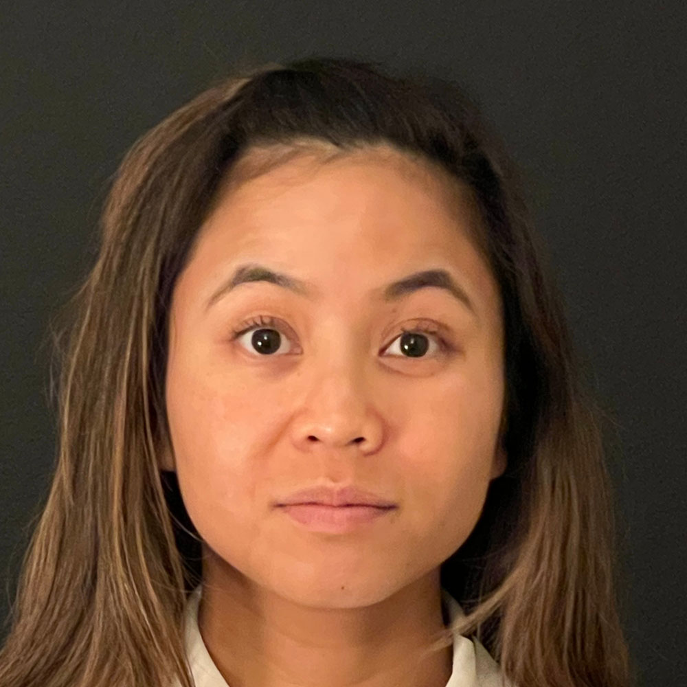 Neurotoxins 0206 After Treatment - Lake Oswego and Portland, Oregon